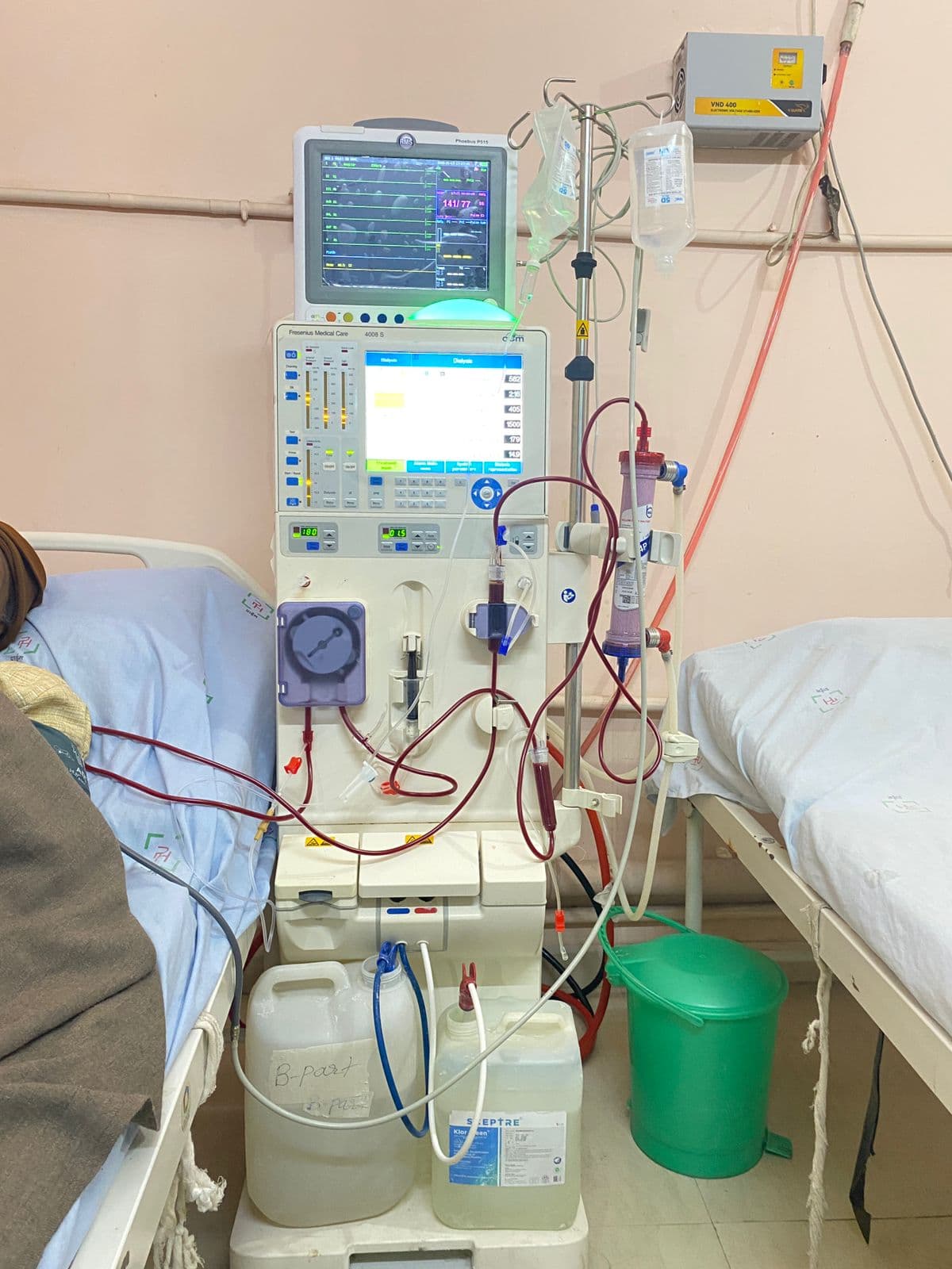 Nephrology & Dialysis at Prime Hospital Ramgarh